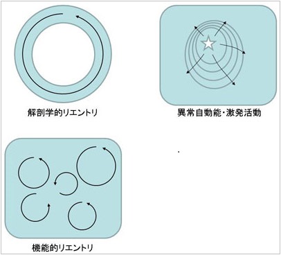 図3. 主な不整脈のメカニズム