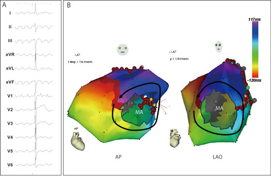  EP 研究中に予想されること