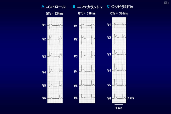 図1. QT短縮症候群患者における各種薬物負荷試験