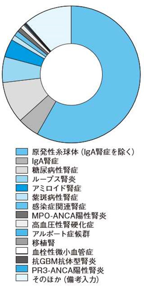 ネフローゼ症候群の病型分類