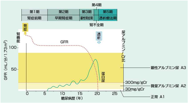 臨床経過(CKD診療ガイド 2012)