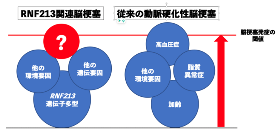 RNF213バリアントと脳梗塞発症の関連