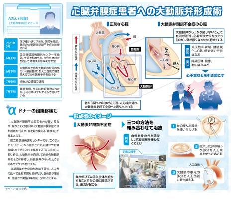 読売新聞2023年11月24日朝刊（読売新聞社より許諾済）