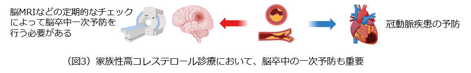 家族性高コレステロール診療において、脳卒中の一次予防も重要
