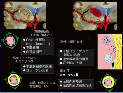 【図3】cnm遺伝子陽性ミュータンス菌が脳内出血を起こすメカニズム