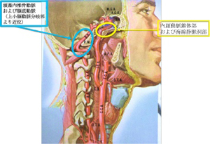 内頚動脈と椎骨脳底動脈の位置関係