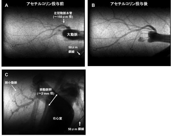 図１　麻酔下のマウス（心拍数～500拍/分）で可視化した冠動脈（A,B）と右心室から肺動脈（C）