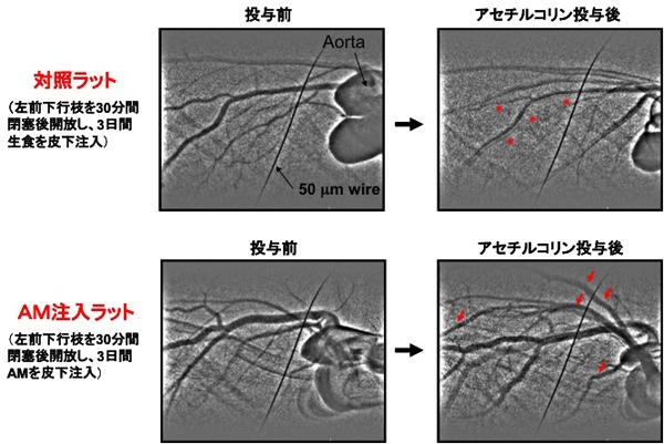 図２　アドレノメデュリン（ＡＭ）はラット心臓虚血再灌流後の冠細動脈内皮機能を改善する