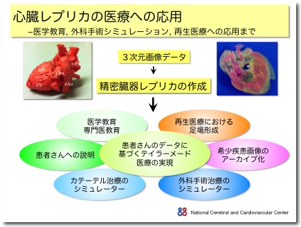 心臓レプリカの医療への応用