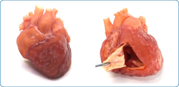 新しいシステムで制作された心臓レプリカ（小児先天性心疾患）