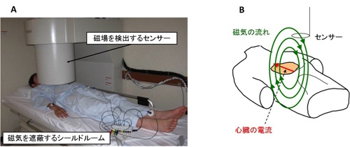 （図1）心磁図検査