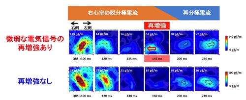 （図2）ARVC患者における心磁図検査の結果