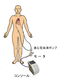 （図1）BR16010の概略図