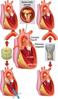 心臓血管内科・外科チームによる弁膜症クリニック