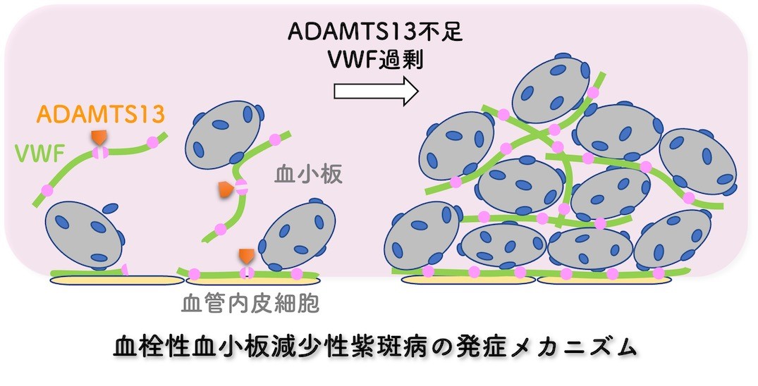 後天性血小板機能障害はどのように治療されますか?