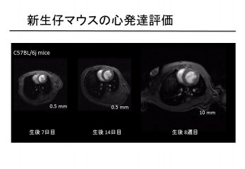 図3　新生仔マウスの心発達過程のMRI画像