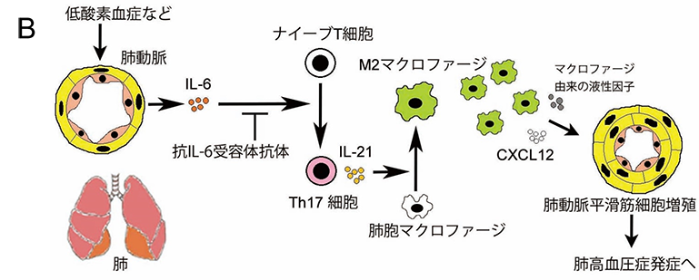 肺動脈性肺高血圧症（PAH）病態形成での炎症性サイトカインの役割解明と新しい治療法開発