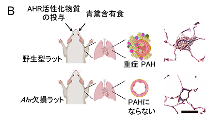 PAH病態形成におけるアリルハイドロカーボン受容体の役割解明と新規の診断・治療法開発