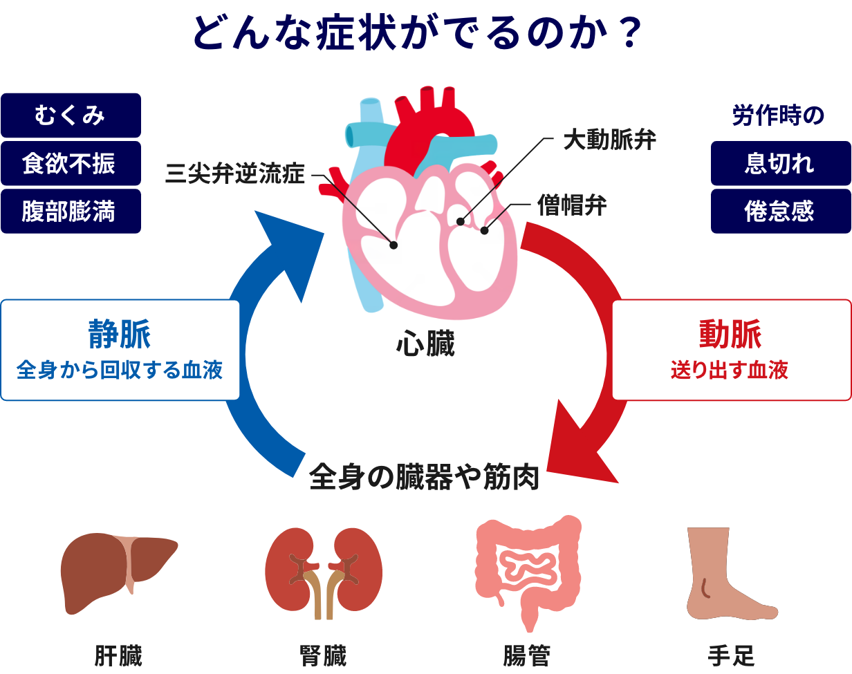 どんな症状がでるのか？