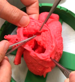 小児先天性心疾患の軟質実物大３D心臓モデルを用いた手術リハーサル