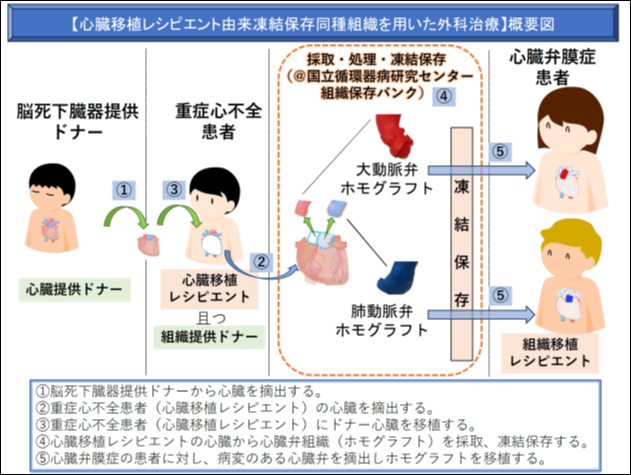 「心臓移植患者からの心臓弁の採取・保存・移植」が先進医療として承認 ― 「もうひとつの移植医療」における日本初・唯一の取り組み ― ～ 命をつなぐ心臓弁移植医療を必要とする全ての人に届けるために ～